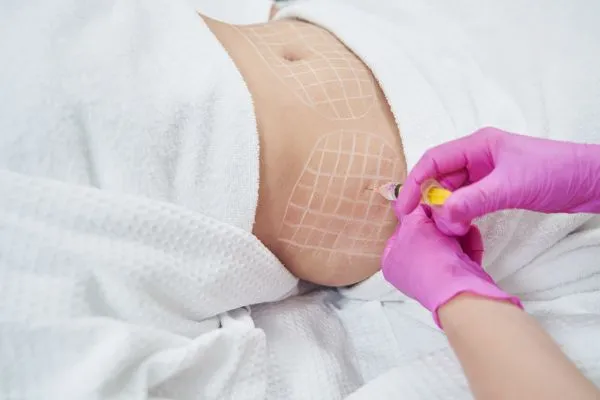 image of fat dissolving injections on love handles to help combat weight gain Margate