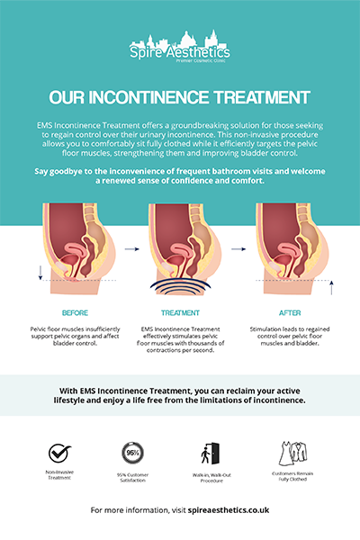 image of how urge incontinence Margate treatment works