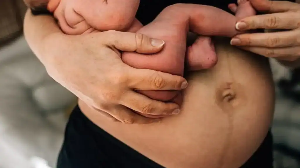 Why Is My Stomach Still Big After Pregnancy Margate?